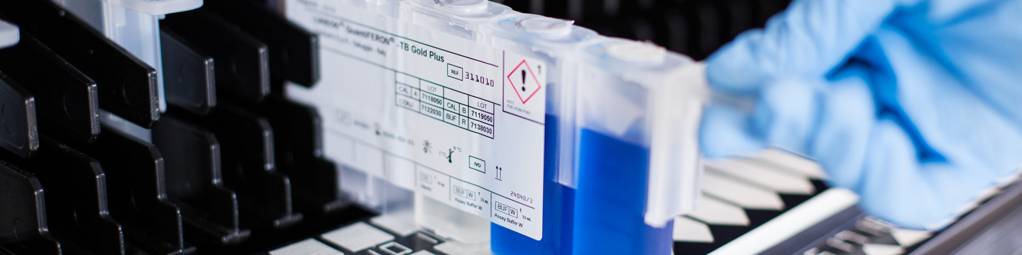 Diasorin_websim7 Diasorin_websim7