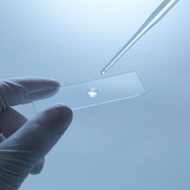 Campione biologico posizionato su un vetrino da laboratorio