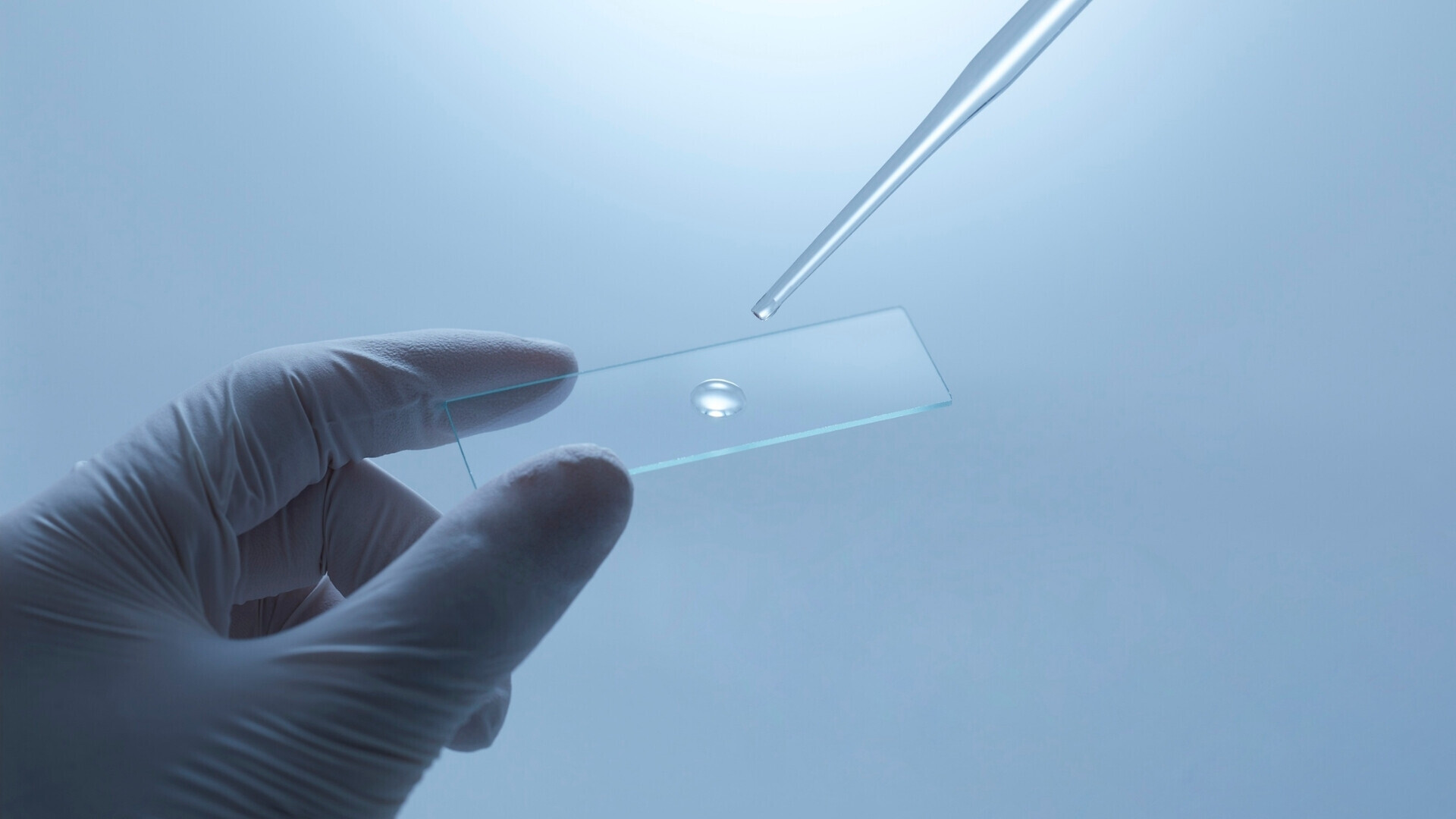 Campione biologico posizionato su un vetrino da laboratorio